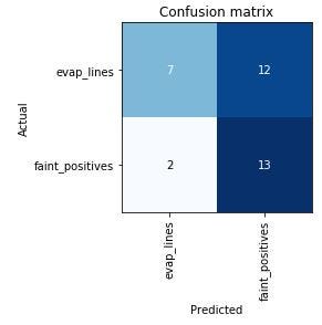 Classifying Pregnancy Test Results | by Laura Langdon | Towards Data Science Classifying Pregnancy Test Results | by Laura Langdon | Towards Data Science
