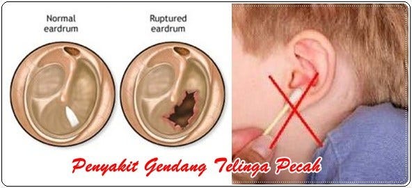 Download 94+ Gambar Gendang Telinga Manusia Terbaru HD