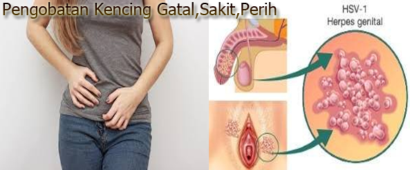 Pengobatan Herbal Buang Air Kecil Terasa Gatalpanassakit