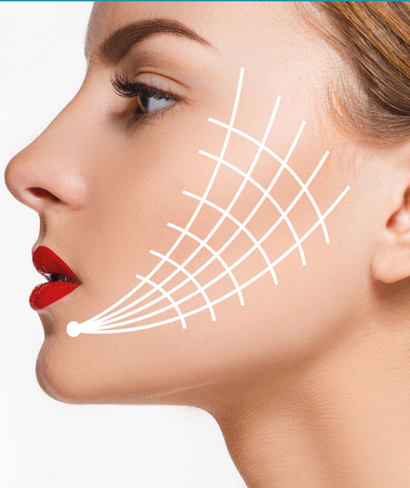 Thread Lift. The Thread Lift procedure offers an… by jack jackson