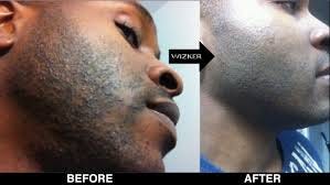 The Do S And Don Ts Of Shaving And Skincare For Black Men