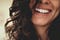 teeth whitening is the ultimate solution to a beautiful smile