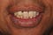 Teeth_Care_Busy_Professional_Smile