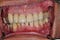 Start_Up_San_Diego_Business_Owner_Teeth