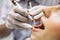 dentist in Gurgaon