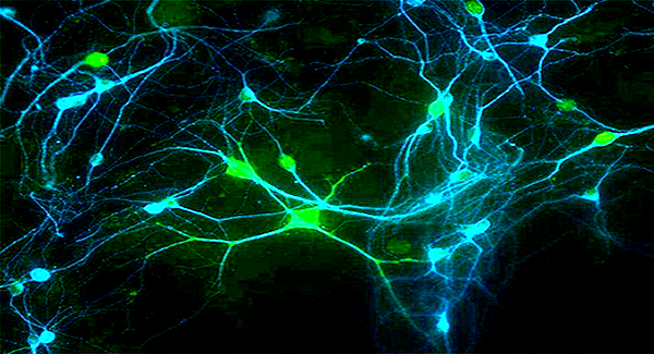 deep learning in spiking neural networks
