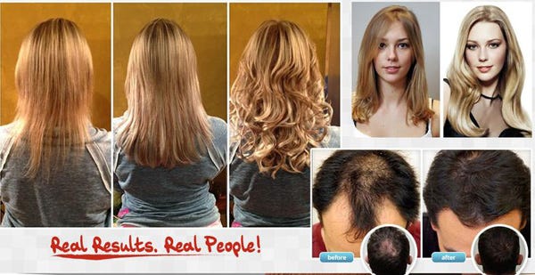 Follinique Free Trial Http Www Healthboostup Com Follinique