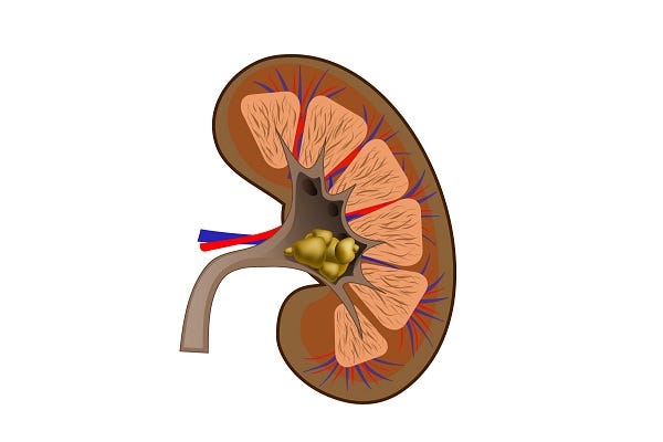 Kidney Stone Size Chart