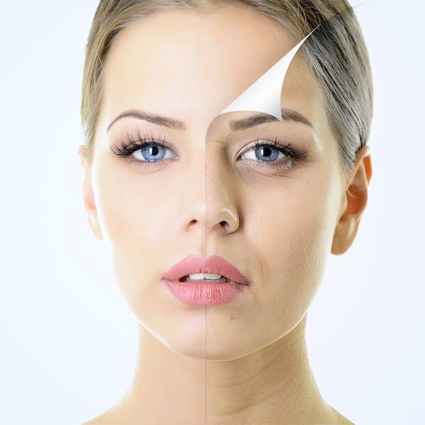 Anti Aging Treatment Oakville Dermazone Medical Spa Oakville By Dermazone Spacenter Medium