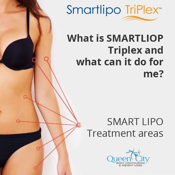 What is SmartLipo Triplex?. Smartlipo Triplex™, is a non-surgical… | by  Queen City Body | Medium