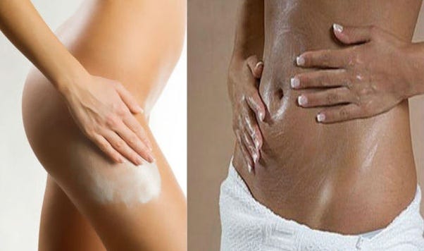 exfoliate stretch marks