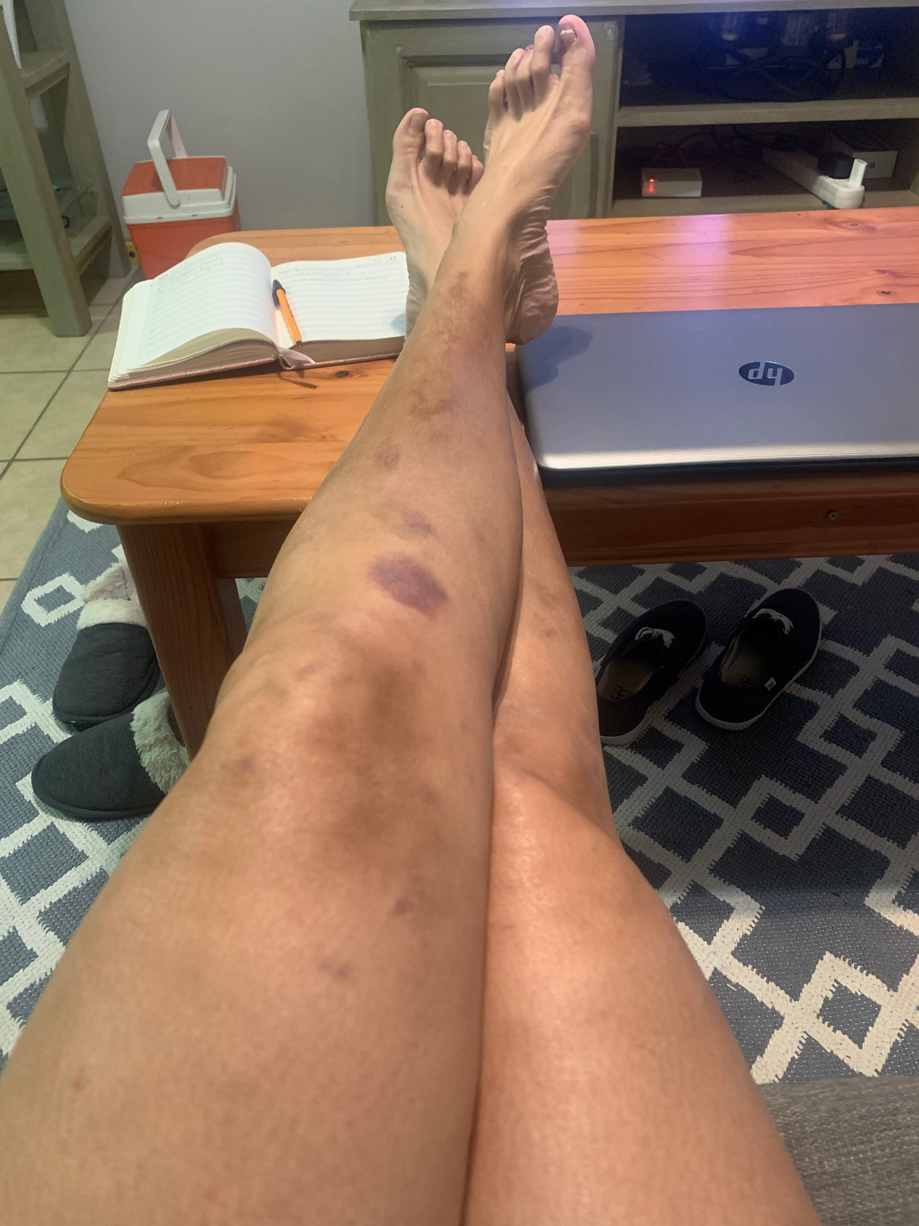 Download Blood Thinners You Really Piss Me Off Coreen Walstra Medium Free HD Wallpaper Blood Thinners You Really Piss Me Off Coreen Walstra Medium HD