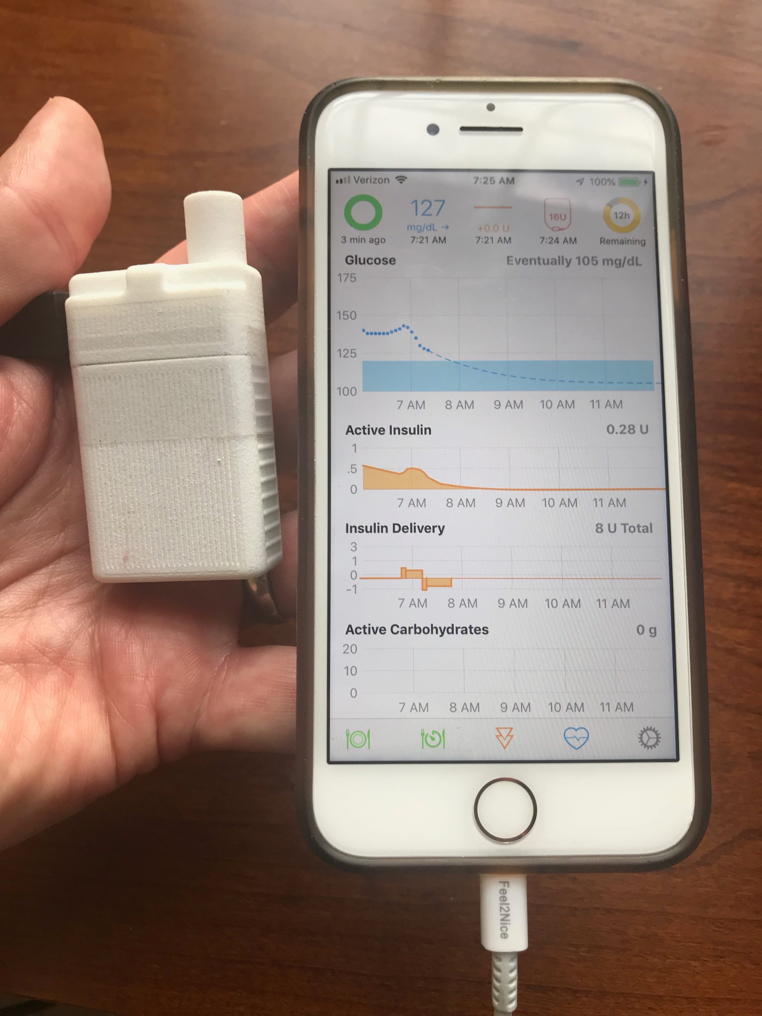 Our first 5 days on Omnipod Loop. On Monday April 22, a test branch of