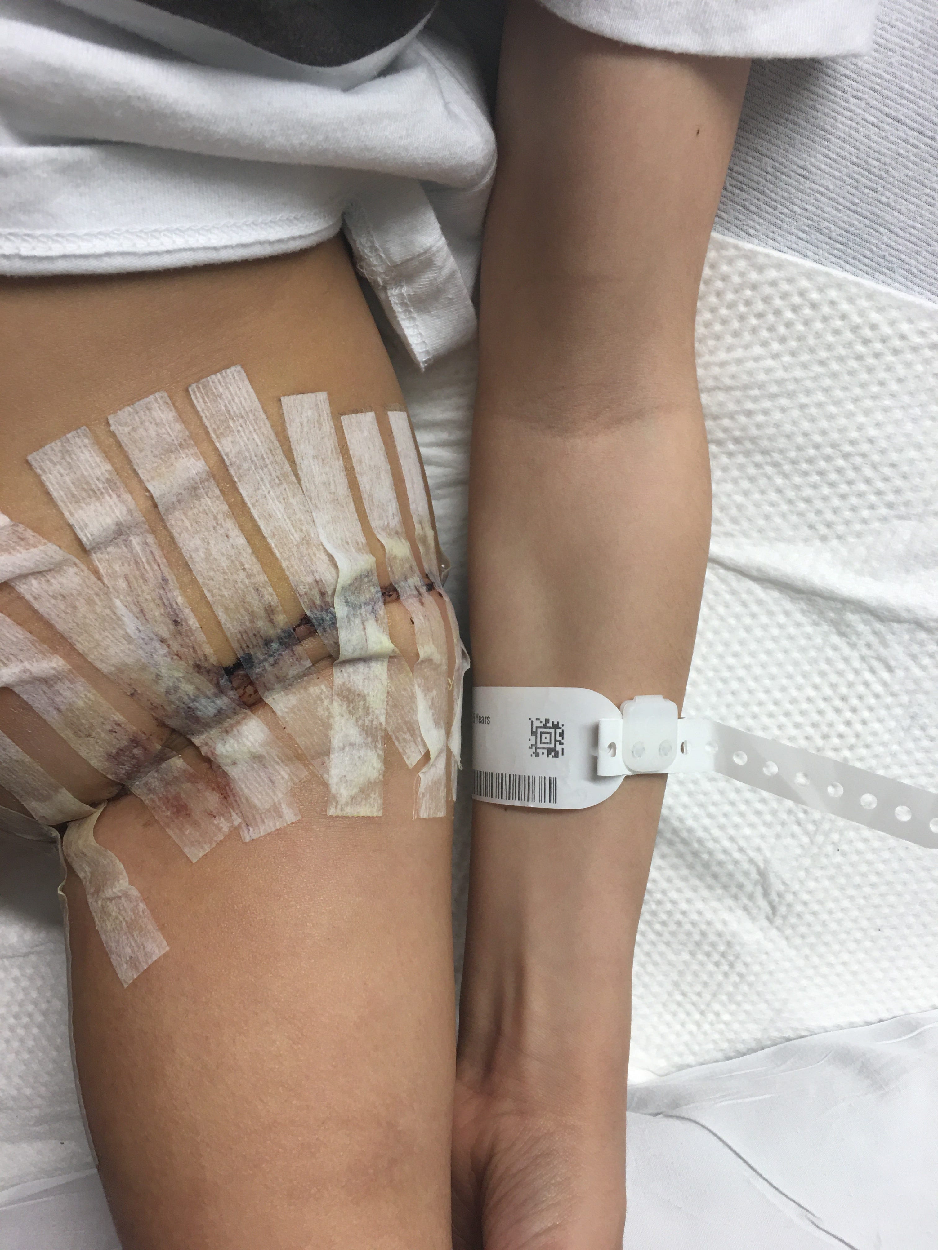 Did I Really Just Willingly Disfigure My Child By J L Pattison Medium