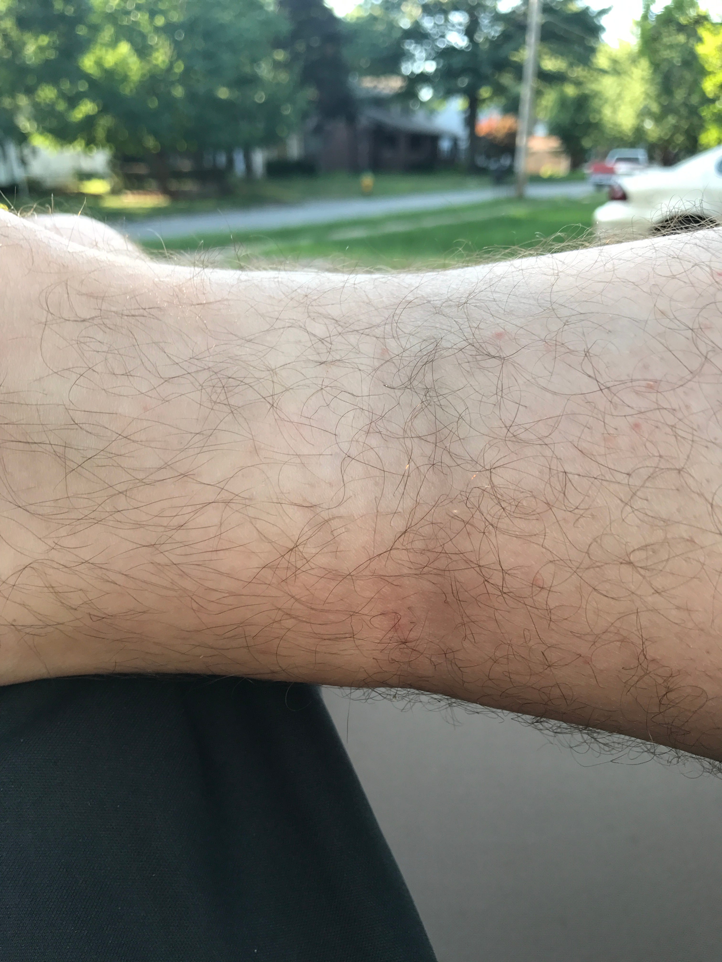 Doctor Says I M Fat Day 1 248 7 Lbs Typed From The Couch Medium