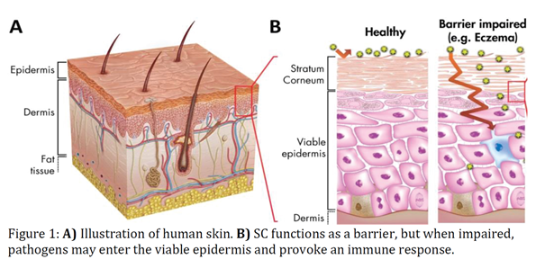 ceramide eczema