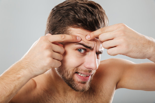control acne on face
