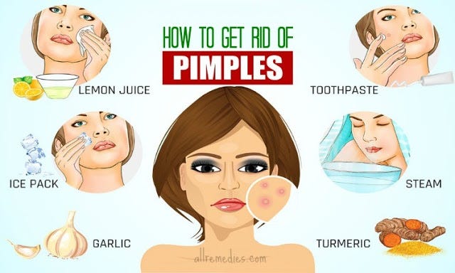 How To Get Rid Of Pimples Are You Suffering From A Pimple By Dilshan Tharaka Medium