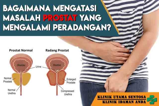 tratamentul prostatitei bunicii prostate cancer psa level 44