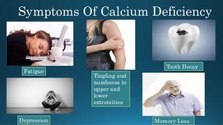 Symptoms Of Calcium Deficiency Hypocalcemia By Azim Abbasi Medium