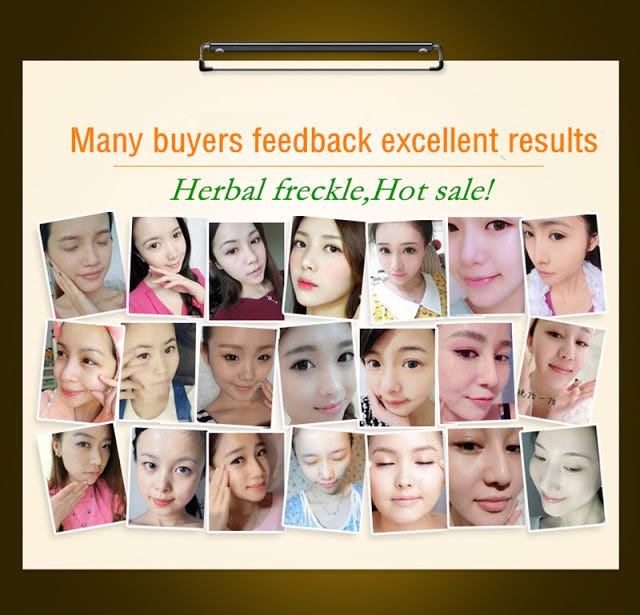 best day cream for skin whitening
