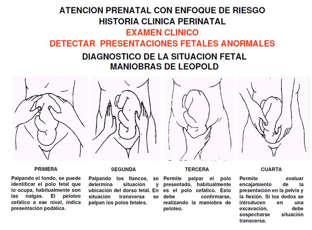 Maniobras de Leopold. Las Maniobras de Lepold son uno de