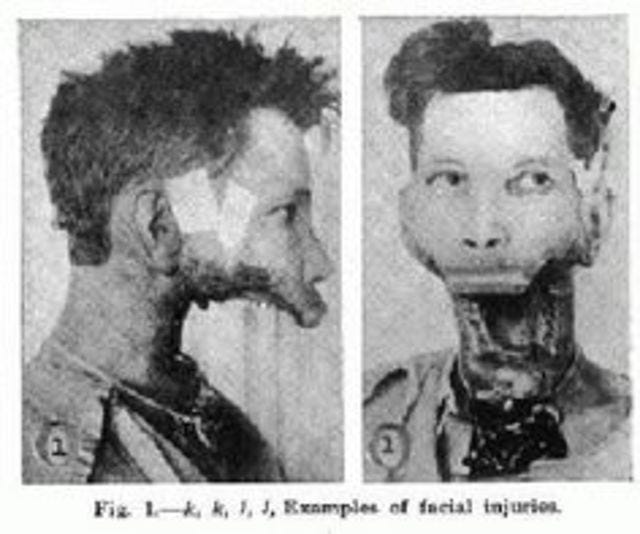 The Jawless Man My Name Is Mia Lanes And I Ll Tell You By Mirella C Santos Medium The Jawless Man My Name Is Mia Lanes And I Ll Tell You By Mirella C Santos Medium