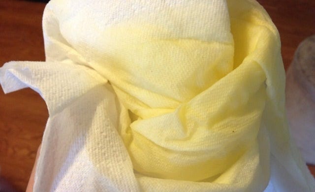 Yellow Discharge Pregnancy Causes Treatment Prevention By Health Pulls Medium