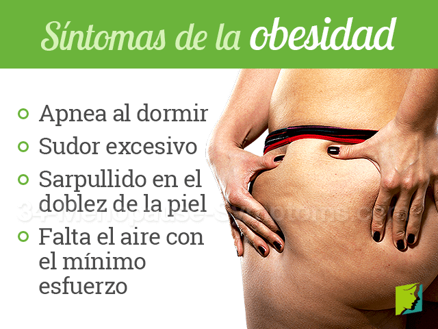 OBESIDAD. QUÉ ES: | by luis paredes tumialan | OBESIDAD | Medium