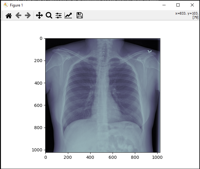 Using Python for Medical Images. If you are just getting started to… by KaliCharan Medium