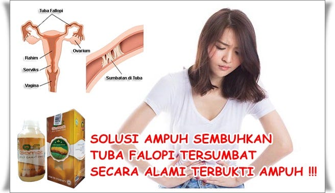 Cara Mengatasi Saluran Tuba Falopi Tersumbat Secara Alami ...