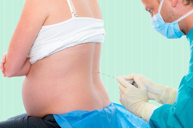 What Is Epidural What Are Its Side Effects During Labor By Dr Sadhana Kala Medium