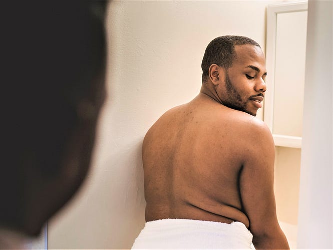 Body dysmorphia in men: How is it different?