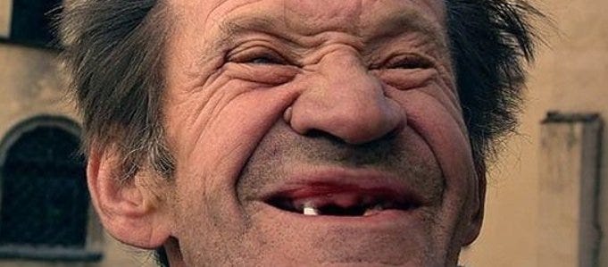 O Sorriso Banguela. Nunca falei aqui do sorriso banguela? | by Caco da ...