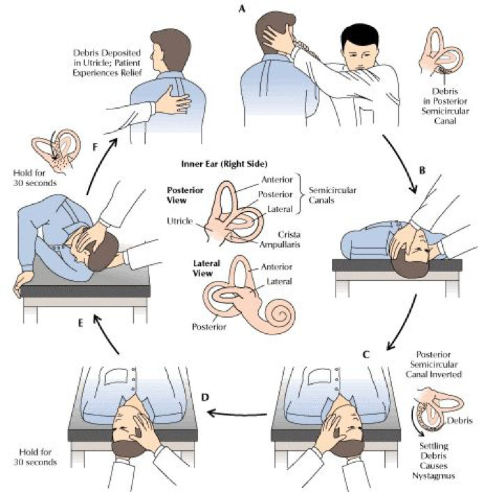 What Is Vertigo And Its Treatment Options By Wellzio Medium