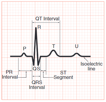 Cara Mudah Interpretasi Ekg Fisiologi Aktivitas Elektrik Jantung By Wulunggono Medium