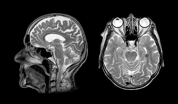 DICOM to JPG and extract all patients information using python. | by Vivek  Kumar | Medium