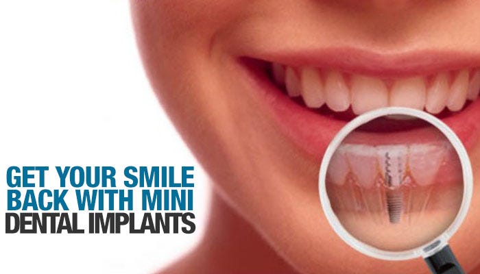 No people teeth with Wonder Crazy: