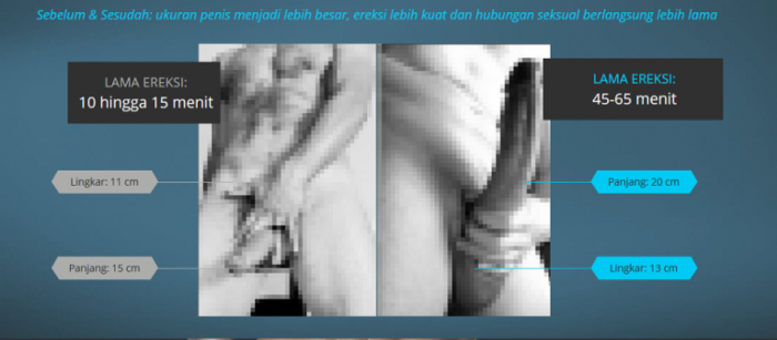 Antar Gratis Forex Surabaya Jual Obat Forex Asli Di Surabaya By Forex Mojokerto Medium