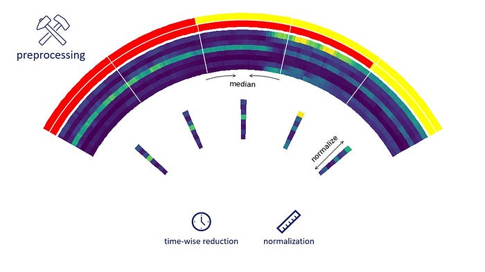 Scheme of the preprocessing pipeline. We obtain a single EMG readings out of a collection of 30 consecutive ones by taking the median of that time series.