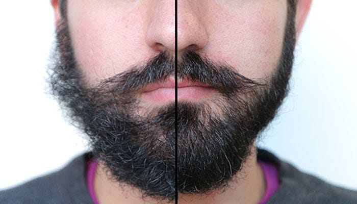 How To Grow A Beard Fast And Thick Mistry Mash Medium