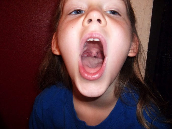 Mounth schoolgirl throat girl