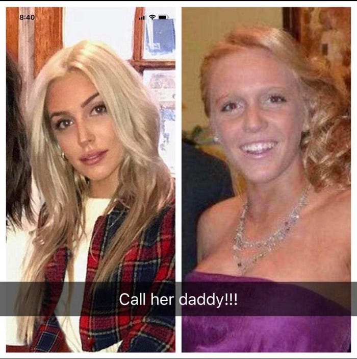 Alex Cooper before and after her glow-up.