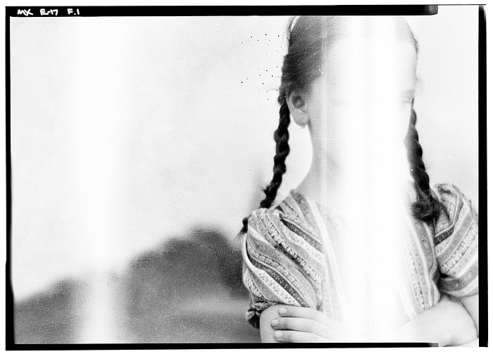 A black-and-white photograph of a girl with dark hair in braided pigtails. Her face has been obscured by a white streak.