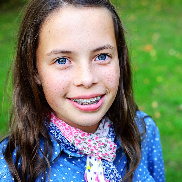 Brackets para niños y dientes de leche — Tratamiento de Ortodoncia by