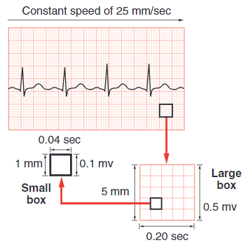 Cara Mudah Interpretasi Ekg Fisiologi Aktivitas Elektrik Jantung By Wulunggono Medium