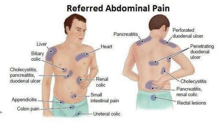 Take The Stress Out Of colic abdomen pain treatment | by parijatak ayurveda | Medium Take The Stress Out Of colic abdomen pain treatment | by parijatak ayurveda | Medium