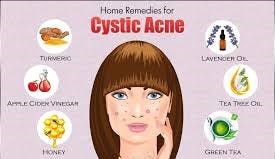 ways to help cystic acne