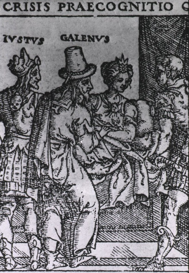  Galen taking the pulse of a patient: 16th-century Venetian woodcut (source)