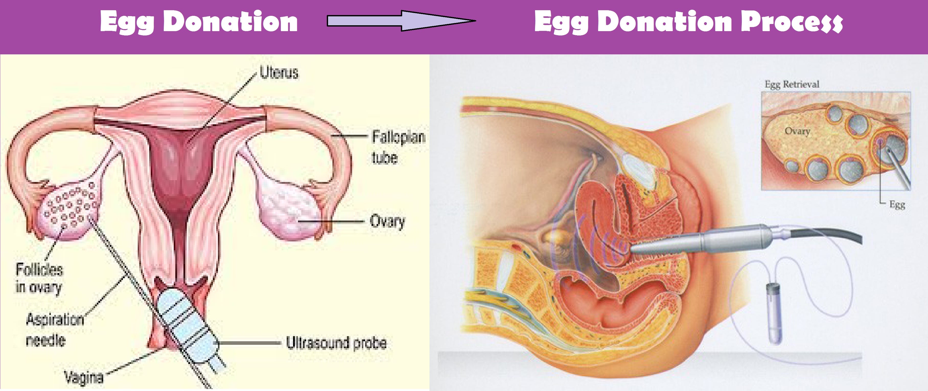 Egg Donation Process Medical Procedure And Its Success Rates In India By Anna Mathews Medium